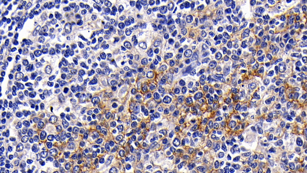 DAB staining on IHC-P; Samples: Human Tonsil Tissue;  Primary Ab: 10µg/ml Rabbit Anti-Human FceRII Antibody Second Ab: 2µg/mL HRP-Linked Caprine Anti-Rabbit IgG Polyclonal Antibody