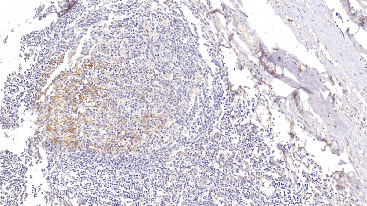 Cluster Of Differentiation 23 (CD23) Polyclonal Antibody - image 3