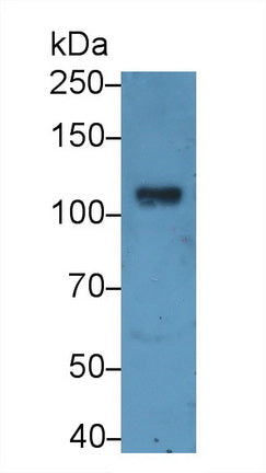 Angiotensin I Converting Enzyme 2 (ACE2) Polyclonal Antibody - image 2