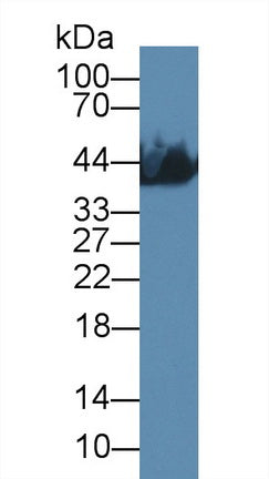 Creatine Kinase, Muscle (CKM) Monoclonal Antibody - image 2