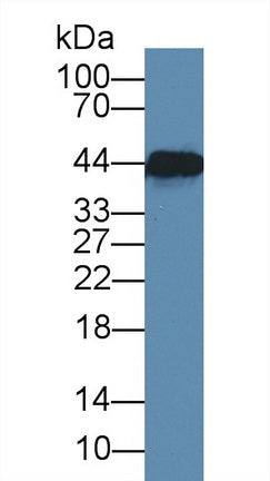 DAB staining on IHC-P; Samples: Human Cerebrum Tissue;  Primary Ab: 20µg/ml Mouse Anti-Human CKM Antibody Second Ab: 2µg/mL HRP-Linked Caprine Anti-Mouse IgG Polyclonal Antibody