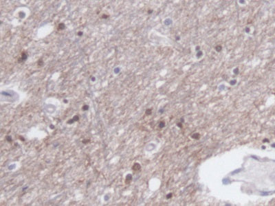 Creatine Kinase, Muscle (CKM) Monoclonal Antibody - image 4