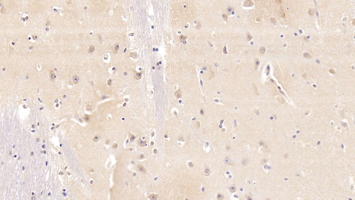 DAB staining on IHC-P; Samples: Human Cardiac Muscle Tissue;  Primary Ab: 20µg/ml Mouse Anti-Human NT-ProBNP Antibody Second Ab: 2µg/mL HRP-Linked Caprine Anti-Mouse IgG Polyclonal Antibody