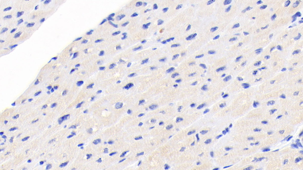 N-Terminal Pro-Brain Natriuretic Peptide (NT-ProBNP) Monoclonal Antibody - image 4