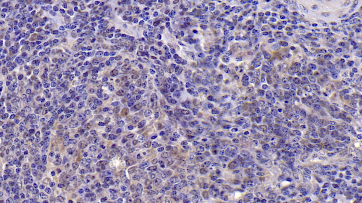 DAB staining on IHC-P; Samples: Porcine Cardiac Muscle Tissue;  Primary Ab: 20µg/ml   Mouse Anti-Porcine IL6 Antibody Second Ab: 2µg/mL HRP-Linked Caprine Anti-Mouse IgG Polyclonal Antibody