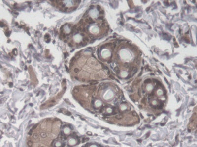 Transforming Growth Factor Beta 1 (TGFb1) Monoclonal Antibody - image 4