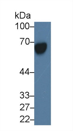 Alpha-Fetoprotein (AFP) Monoclonal Antibody - image 2