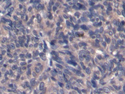 Alpha-Fetoprotein (AFP) Monoclonal Antibody - image 4