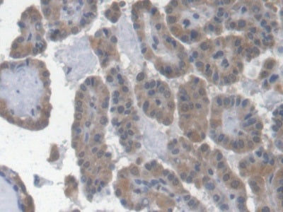 Erythropoietin (EPO) Monoclonal Antibody - image 4