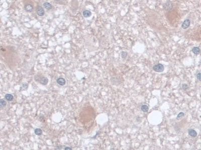 Aspartate Aminotransferase (AST) Monoclonal Antibody - image 4