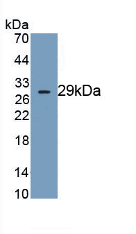 Dynein, Axonemal, Heavy Chain 11 (DNAH11) Monoclonal Antibody - image 2