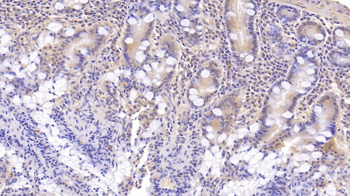 Dynein, Axonemal, Heavy Chain 11 (DNAH11) Monoclonal Antibody - image 3