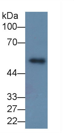 Matrix Metalloproteinase 8 (MMP8) Monoclonal Antibody - image 2
