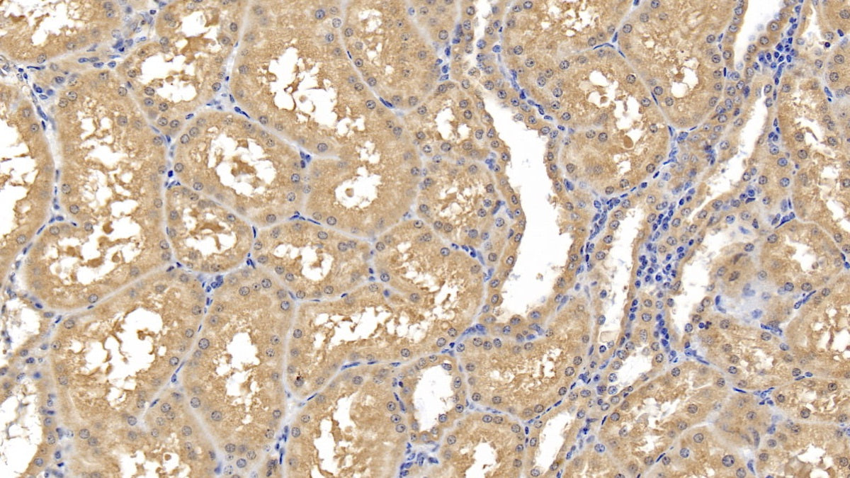 DAB staining on IHC-P; Samples: Human Placenta Tissue; Primary Ab: 20µg/ml Mouse Anti-Human MMP8 Antibody Second Ab: 2µg/mL HRP-Linked Caprine Anti-Mouse IgG Polyclonal Antibody
