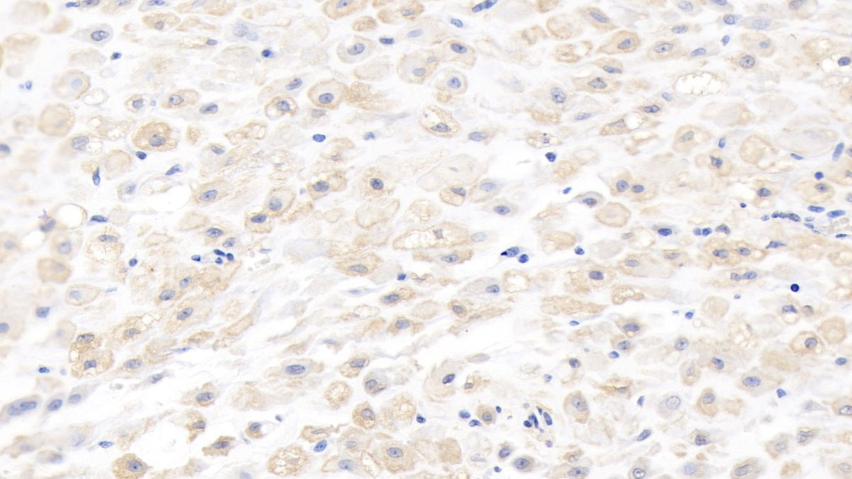 Matrix Metalloproteinase 8 (MMP8) Monoclonal Antibody - image 4