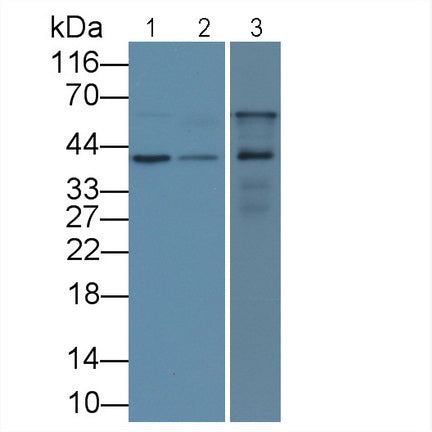 Insulin Like Growth Factor Binding Protein 3 (IGFBP3) Monoclonal Antibody - image 2