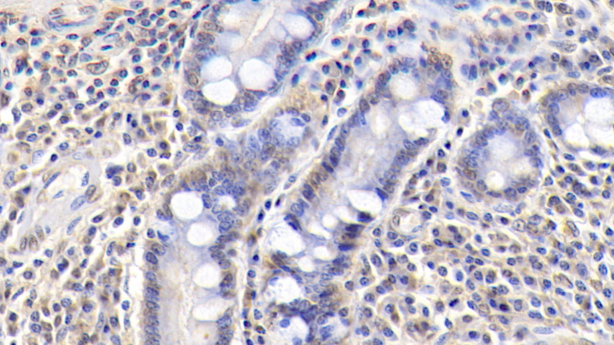 Insulin Like Growth Factor Binding Protein 3 (IGFBP3) Monoclonal Antibody - image 3