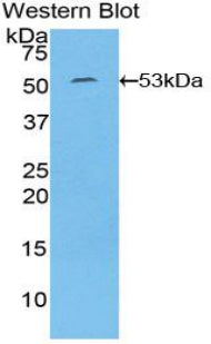 Interleukin 6 (IL6) Polyclonal Antibody - image 2