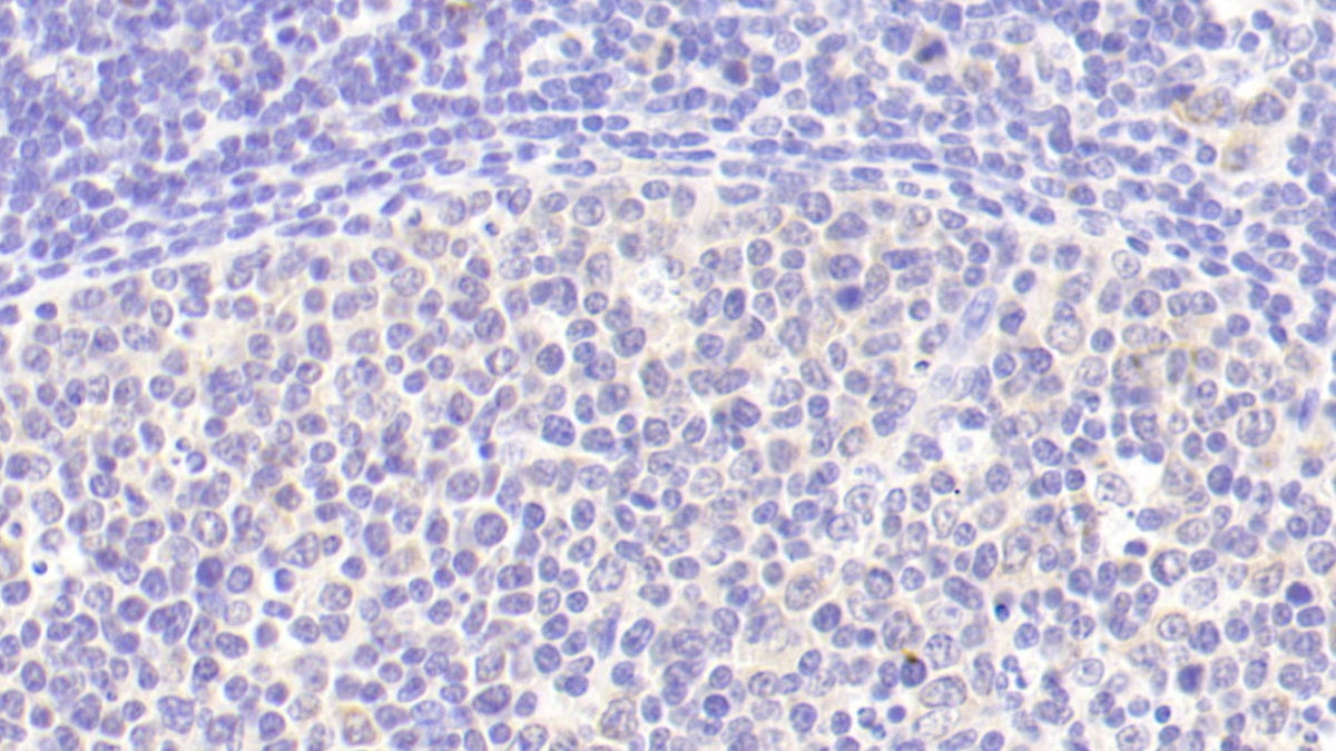 DAB staining on IHC-P; Samples: Human Spleen Tissue;  Primary Ab: 20μg/ml Rabbit Anti-Human IL6 Antibody Second Ab: 2µg/mL HRP-Linked Caprine Anti-Rabbit IgG Polyclonal Antibody