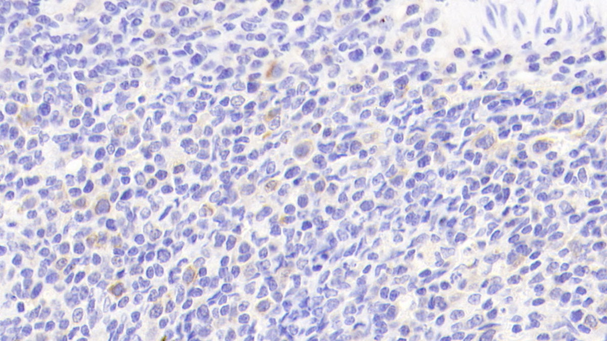 Interleukin 6 (IL6) Polyclonal Antibody - image 4