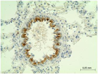 Adrenergic Receptor Beta 2 (ADRb2) Polyclonal Antibody - image 2