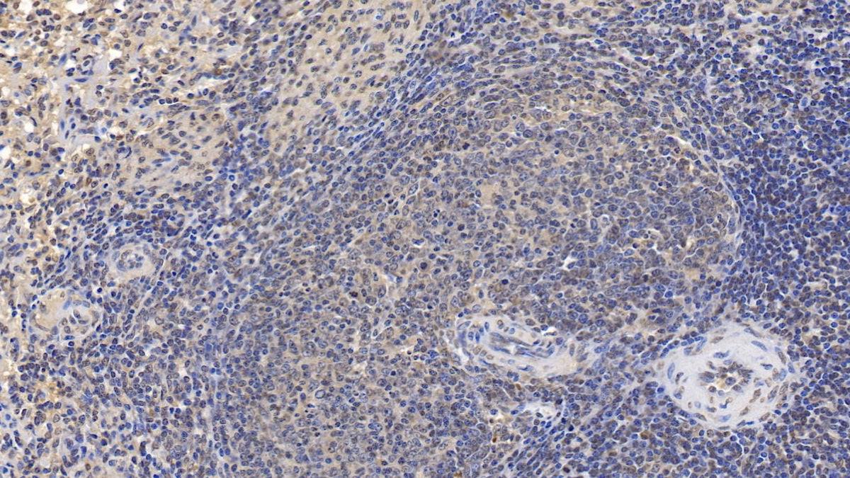 DAB staining on IHC-P; Samples: Human Colon Tissue; Primary Ab: 30µg/ml Mouse Anti-Human GATA3 Antibody Second Ab: 2µg/mL HRP-Linked Caprine Anti-Mouse IgG Polyclonal Antibody