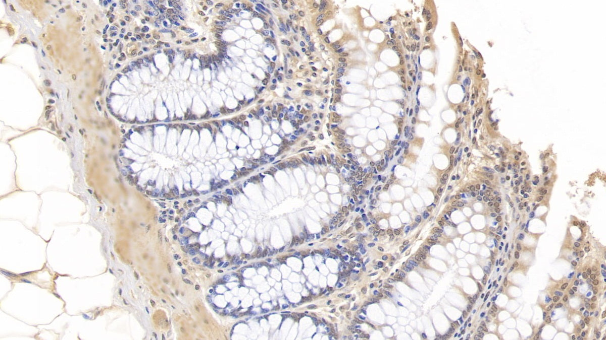 DAB staining on IHC-P; Samples: Porcine Kidney Tissue;  Primary Ab: 30µg/ml   Mouse Anti-Porcine IL10 Antibody Second Ab: 2µg/mL HRP-Linked Caprine Anti-Mouse IgG Polyclonal Antibody