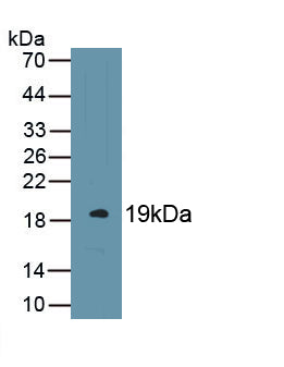 Endothelial protein C receptor (EPCR) Monoclonal Antibody - image 2