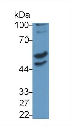 Doublecortin Like Kinase 1 (DCLK1) Monoclonal Antibody - image 2