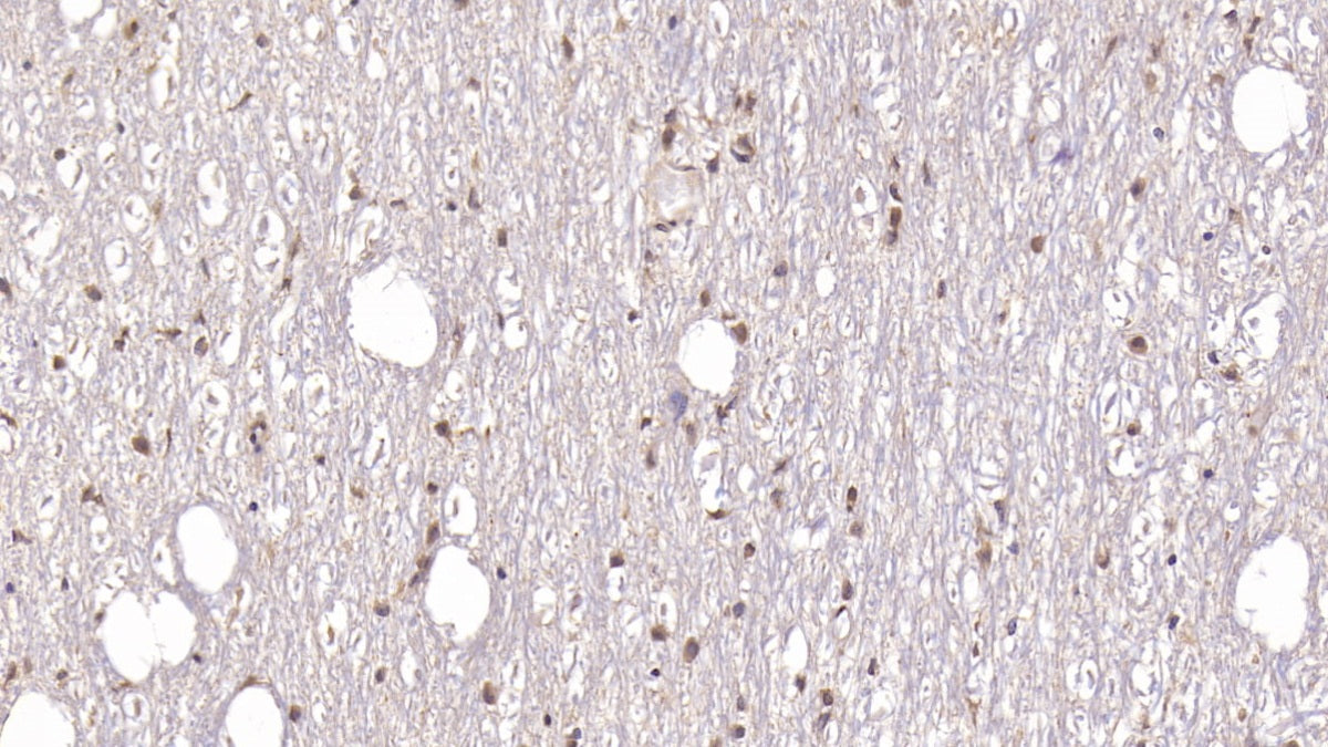 DAB staining on IHC-P; Samples: Human Cerebrum Tissue;  Primary Ab: 20µg/ml Mouse Anti-Human DCLK1 Antibody Second Ab: 2µg/mL HRP-Linked Caprine Anti-Mouse IgG Polyclonal Antibody