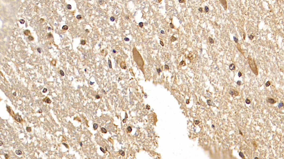 Doublecortin Like Kinase 1 (DCLK1) Monoclonal Antibody - image 4