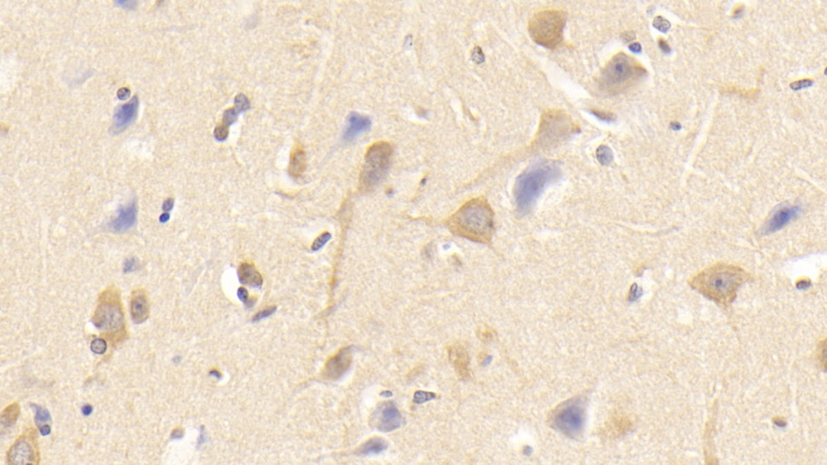 Sialic Acid Binding Ig Like Lectin 8 (SIGLEC8) Monoclonal Antibody - image 3