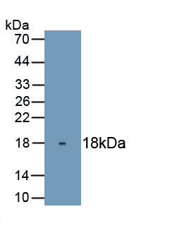 Tumor Protein P63 (TP63) Monoclonal Antibody - image 2