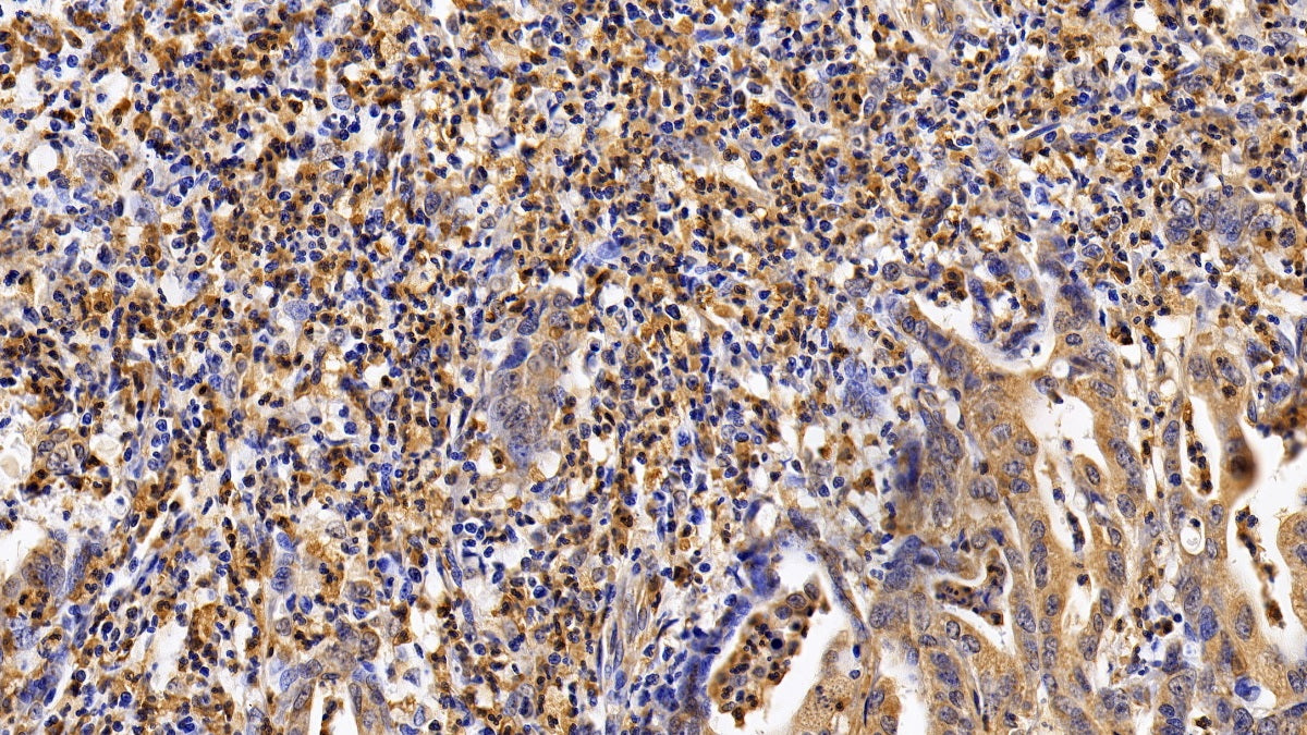 Interleukin 4 Receptor (IL4R) Polyclonal Antibody - image 3