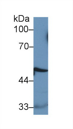 Cathepsin D (CTSD) Monoclonal Antibody - image 2