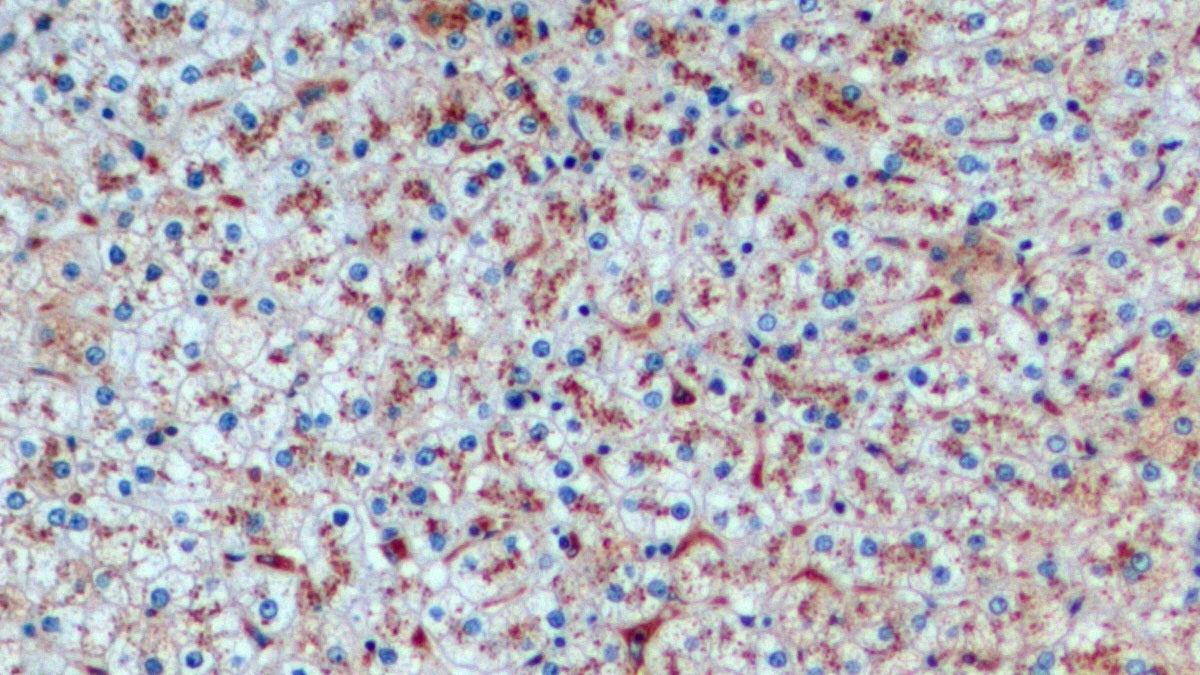 FITC staining on IF; Samples: Human MCF7 Cells;  Primary Ab: 40µg/ml Mouse Anti-Human CTSD Antibody