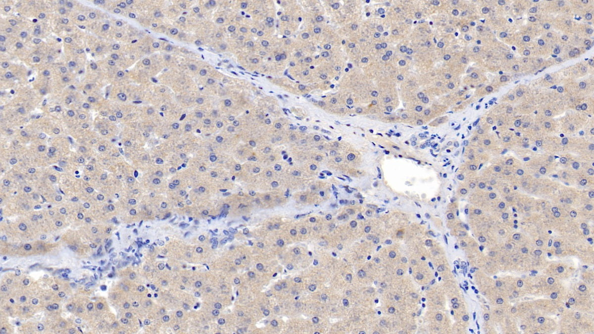 DAB staining on IHC-P; Samples: Human Placenta Tissue; Primary Ab: 10µg/ml Mouse Anti-Human ACVR2A Antibody Second Ab: 2µg/mL HRP-Linked Caprine Anti-Mouse IgG Polyclonal Antibody