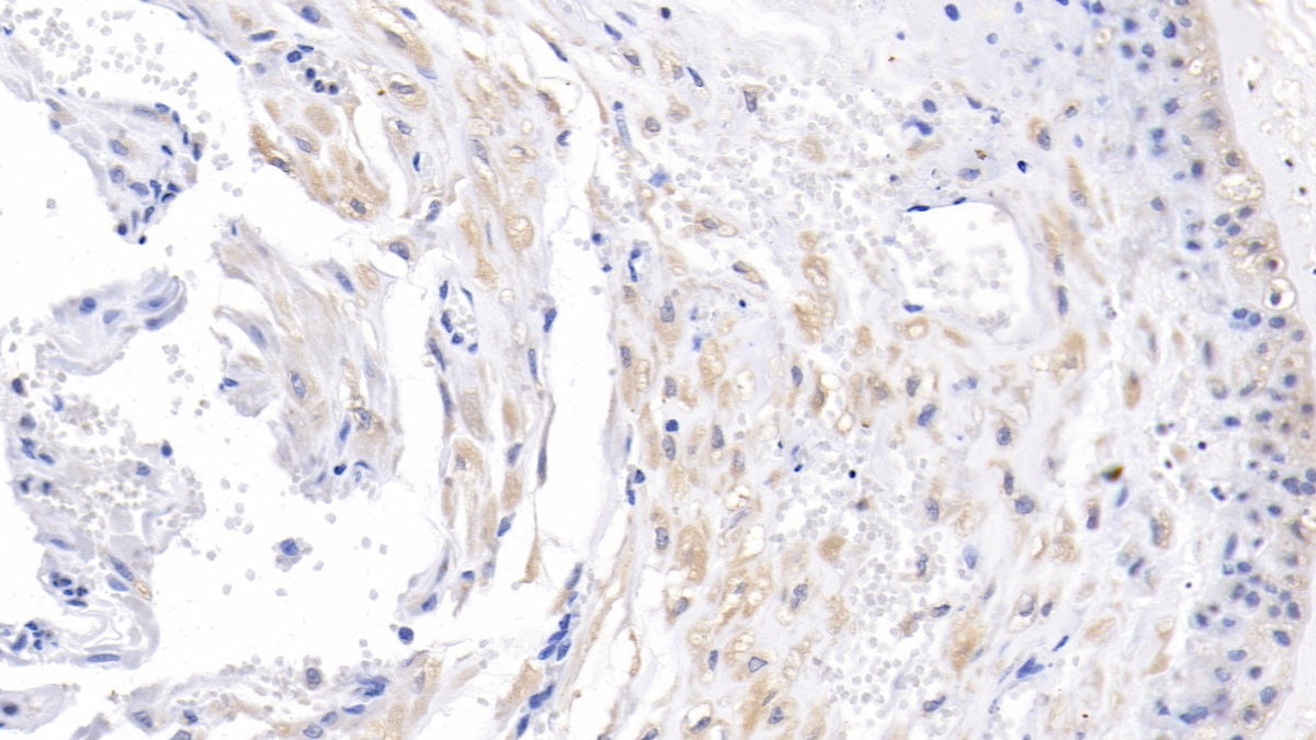 Activin A Receptor Type II A (ACVR2A) Monoclonal Antibody - image 4
