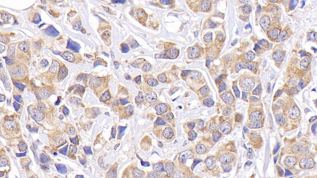 B-Cell Leukemia/Lymphoma 2 (Bcl2) Monoclonal Antibody - image 3