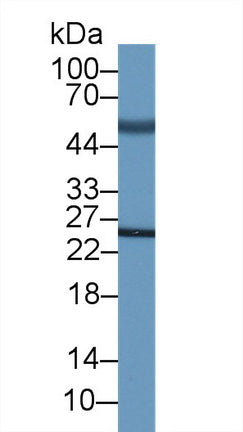 Adrenocorticotropic Hormone (ACTH) Monoclonal Antibody - image 2