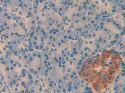 Amylin (Amylin) Monoclonal Antibody - image 2