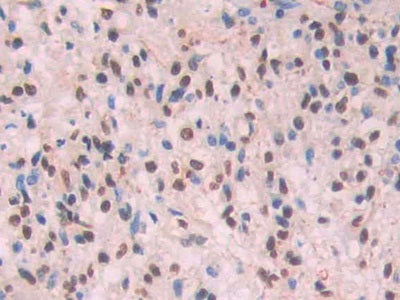 Amyloid Beta Peptide 1-42 (Ab1-42) Monoclonal Antibody - image 4
