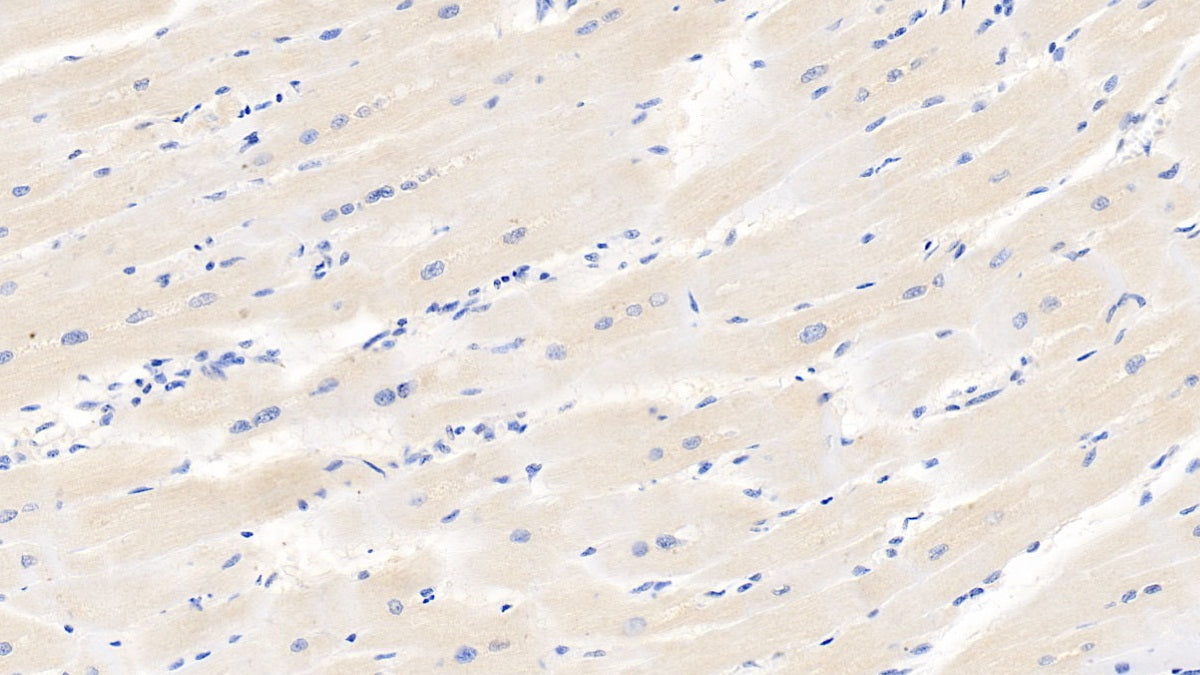 DAB staining on IHC-P; Samples: Human Kidney Tissue;  Primary Ab: 10µg/ml Mouse Anti-Human HIF1a Antibody Second Ab: 2µg/mL HRP-Linked Caprine Anti-Mouse IgG Polyclonal Antibody