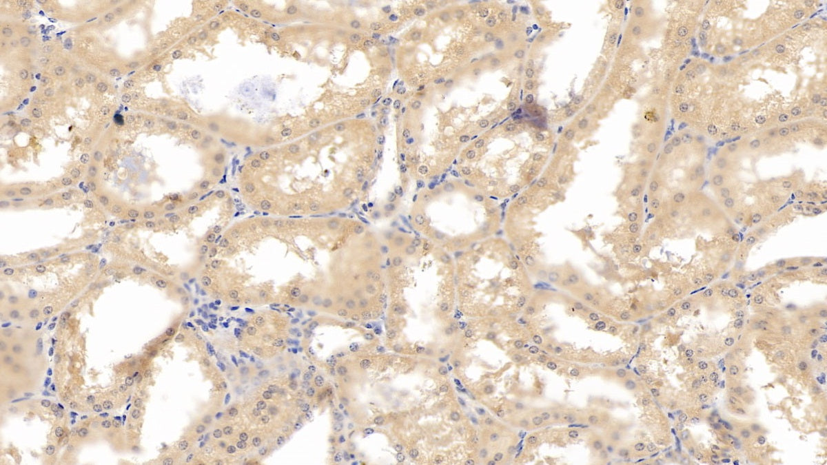 Hypoxia Inducible Factor 1 Alpha (HIF1a) Monoclonal Antibody - image 4