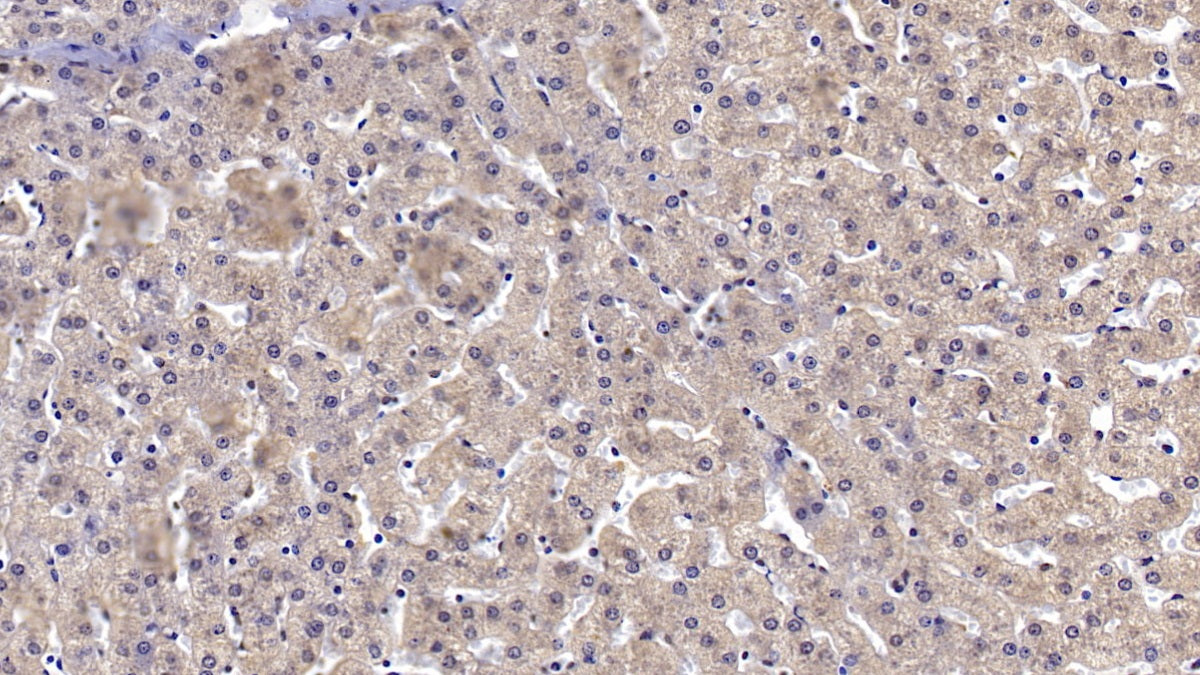 DAB staining on IHC-P; Samples: Human Kidney Tissue;  Primary Ab: 10µg/ml Mouse Anti-Human ANXA3 Antibody Second Ab: 2µg/mL HRP-Linked Caprine Anti-Mouse IgG Polyclonal Antibody