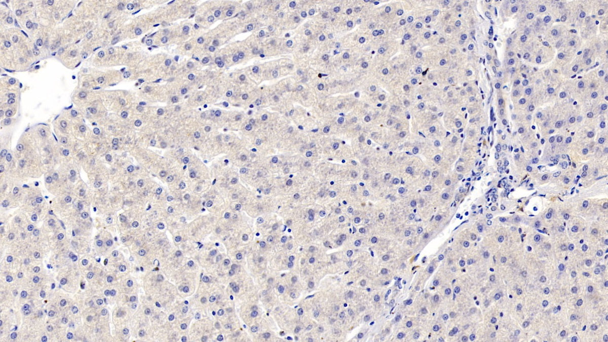 Annexin A3 (ANXA3) Monoclonal Antibody - image 4