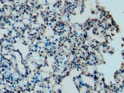 DAB staining on IHC-P; Samples: Mouse Liver Tissue;  Primary Ab: 10µg/ml Mouse Anti-Mouse APOC1 Antibody Second Ab: 2µg/mL HRP-Linked Caprine Anti-Mouse IgG Polyclonal Antibody