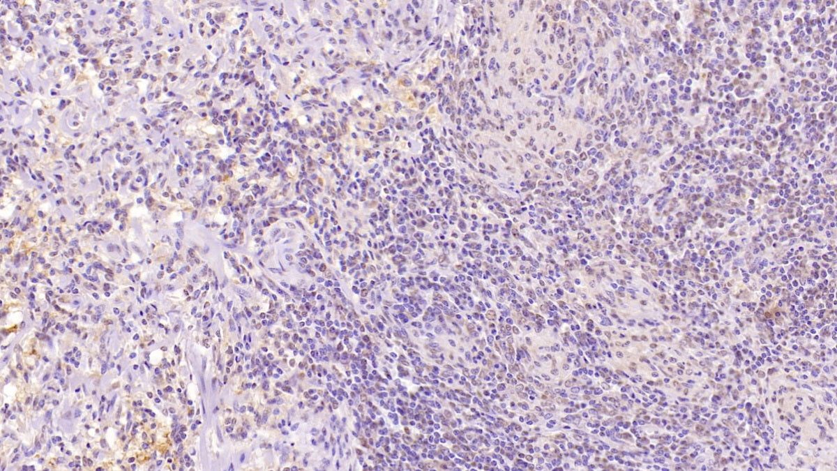 DAB staining on IHC-P; Samples: Human Cerebrum Tissue;  Primary Ab: 40µg/ml Mouse Anti-Human CD97 Antibody Second Ab: 2µg/mL HRP-Linked Caprine Anti-Mouse IgG Polyclonal Antibody