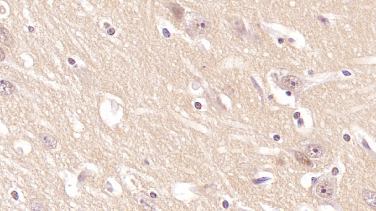 Cluster Of Differentiation 97 (CD97) Monoclonal Antibody - image 4