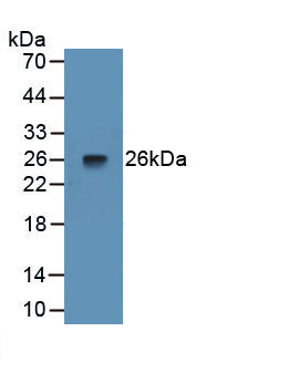 Pentraxin 3, Long (PTX3) Monoclonal Antibody - image 2